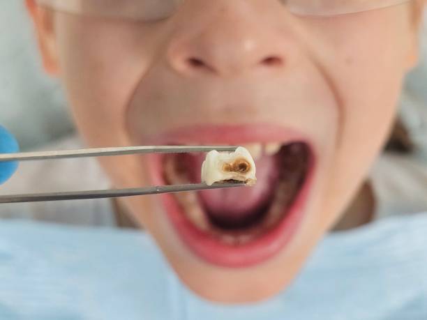 Best Holiday Emergency Dentist in Langdon, ND